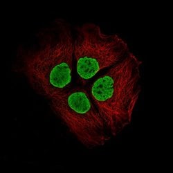 Histone H2AY/macroH2A.1 Antibody (CL5245), Novus Biologicals 25 &mu;L:Antibodies,